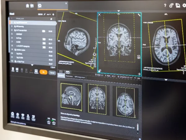 Quand faut-il faire des examens suite à des maux de tête?