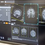 Wanneer moeten er onderzoeken worden gedaan naar aanleiding van hoofdpijn?