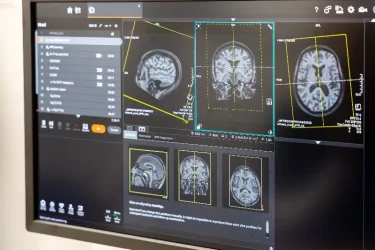Quand faut-il faire des examens suite à des maux de tête?