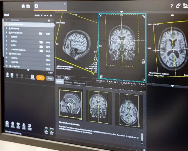 Quand faut-il faire des examens suite à des maux de tête?