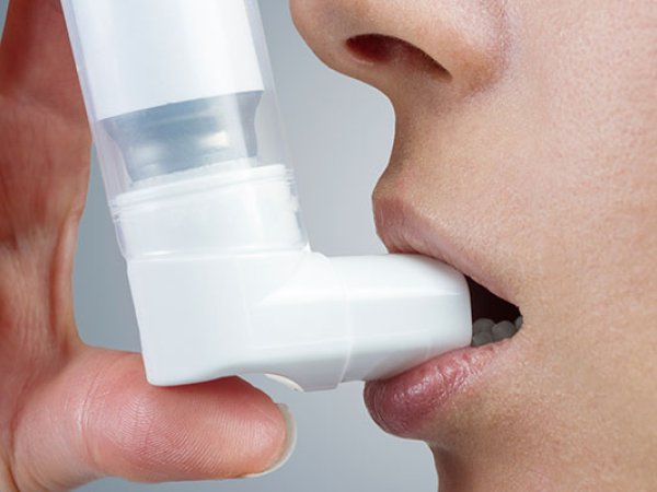 Qu’est-ce qu’un asthme sévère?
