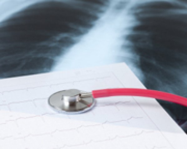 COPD: wanneer een arts raadplegen?