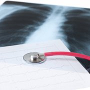 COPD: wanneer een arts raadplegen?