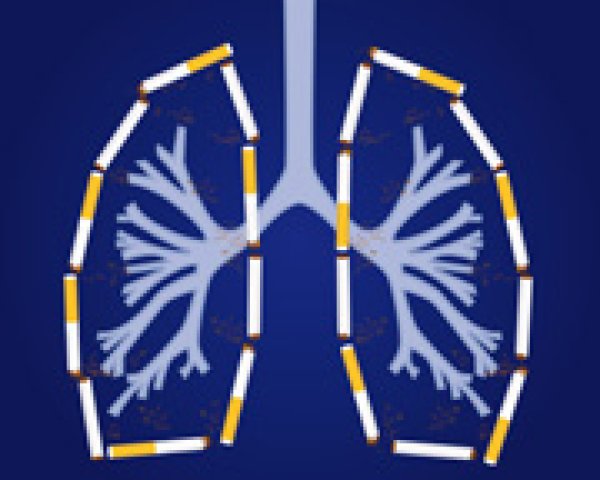 La bronchite chronique: maladie du fumeur