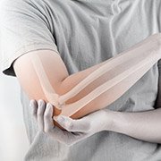 Oorzaken en symptomen van psoriatische artritis