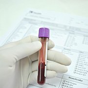 Diagnose van aHus: bloed- en urineonderzoek