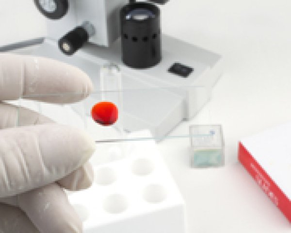 Bloedonderzoek voor het opsporen van malaria