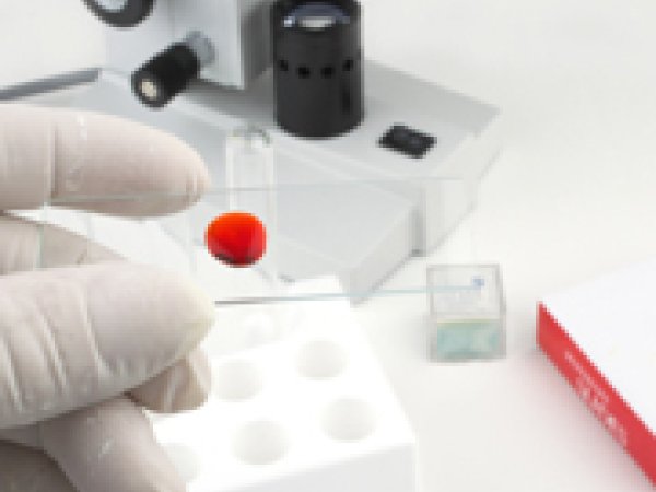 Examen sanguin pour détecter la malaria