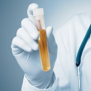 Examens urinaires et imagerie médicale