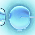 In-vitrofertilisatie (IVF)