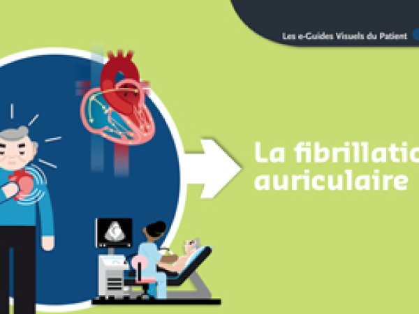 Fibrillation auriculaire