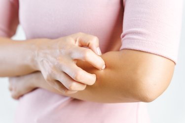 Eczéma de contact ou dermatite atopique: quelles différences?
