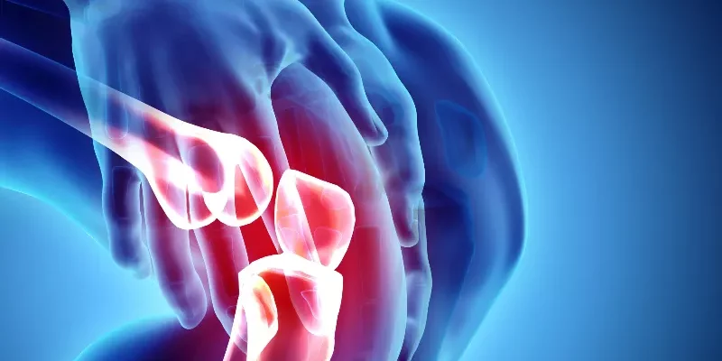Arthrose: bien manger, un traitement naturel au quotidien