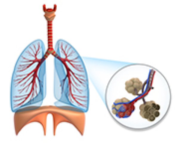 Bronchite aiguë - Les bronches, au centre de l'appareil respiratoire