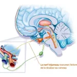 Qu’est-ce qu’une migraine?