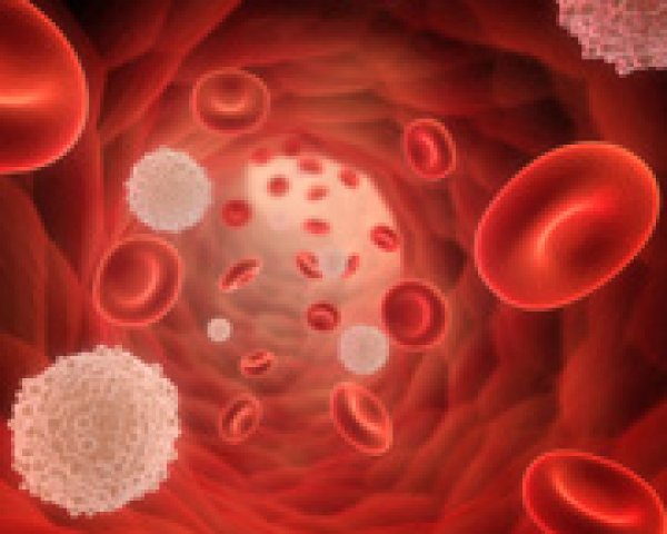 Myélodysplasie et cellules sanguines
