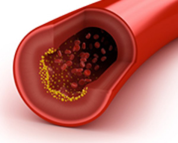 Les origines du cholestérol
