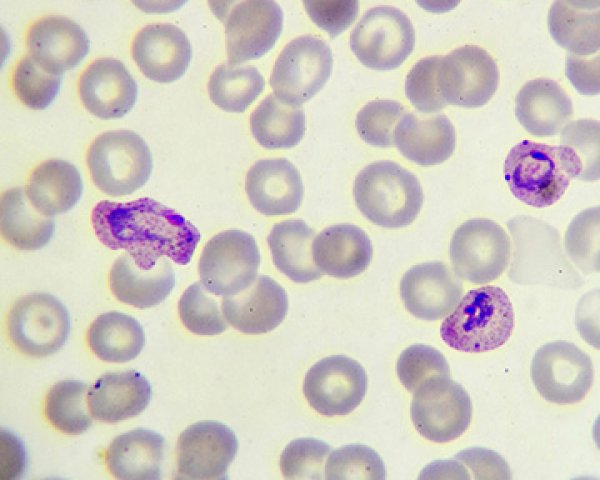 Welke parasieten veroorzaken malaria?