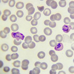Quels parasites provoquent la malaria?