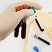 Bloedafname en urineonderzoek