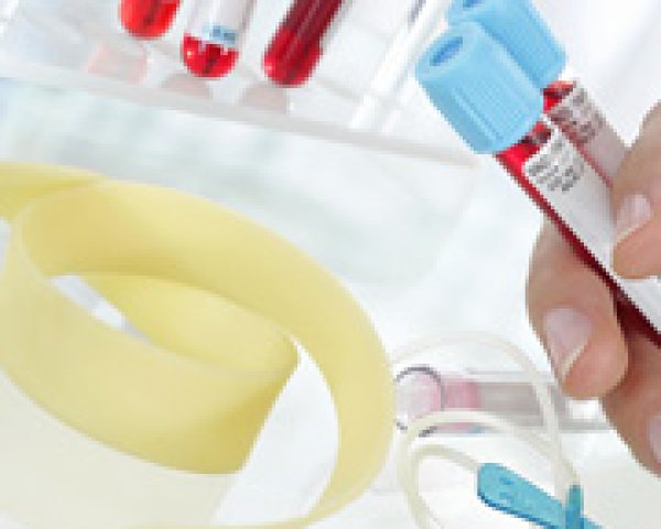 Bloedtesten voor diagnose en opvolging van hepatitis C