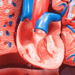 Wat is arteriële hypertensie?