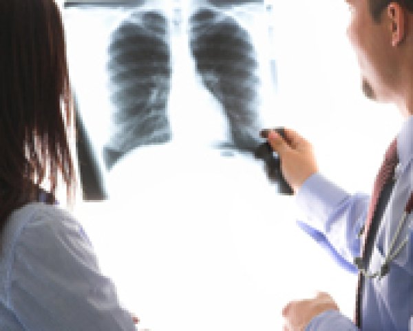 Symptômes au stade initial du cancer du poumon