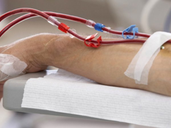Dialyse: mogelijke complicaties?