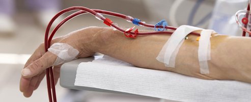 Dialyse: des complications possibles?