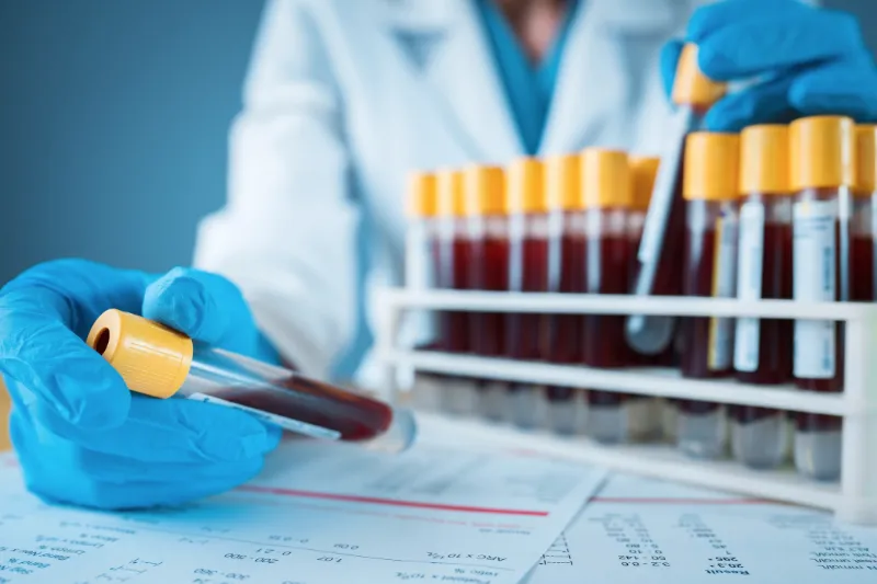 Alzheimer - Nouveau test sanguin pour la maladie d'Alzheimer | Medipedia