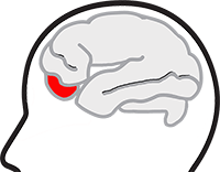 OUCH Belgium ASBL - Algie vasculaire de la face - Cluster headache - Céphalée en grappe 